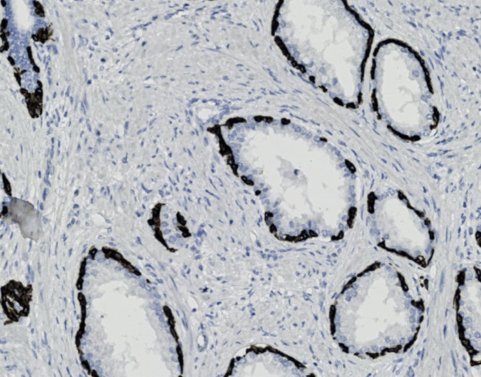 Tissue-Tek Genie<sup>&reg;</sup><br />anti-Cytokeratin 14