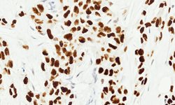 <p>Tissue-Tek Genie<sup>&reg;</sup><br />
anti-TRPS1</p>
