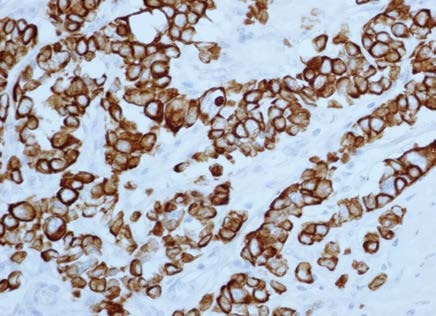 Cytokeratin