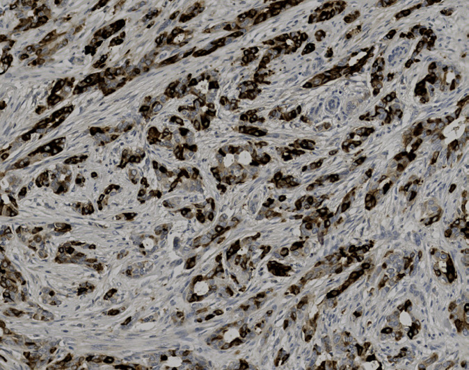 Tissue-Tek Genie<sup>®</sup><br />anti-Mammaglobin Tissue-Tek Genie<sup>®</sup><br />anti-Mammaglobin