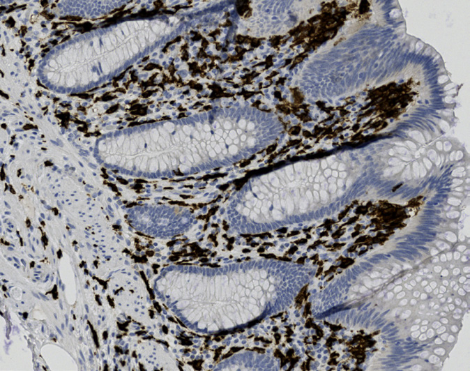 Tissue-Tek Genie anti-CD163