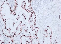 Thyroid Transcription Factor-1 (TTF-1)