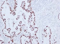 Thyroid Transcription Factor-1 (TTF-1)