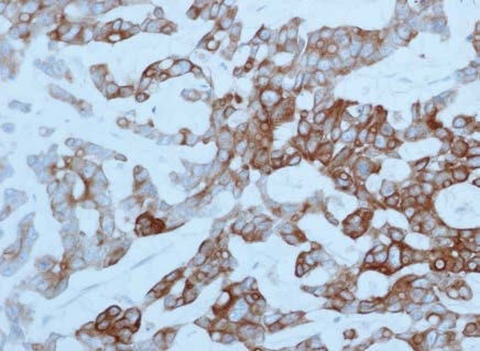 Cytokeratin 20