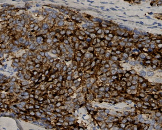 Tissue-Tek Genie anti-Cytokeratin 20
