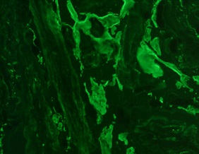 Tissue-Tek Genie FITC anti-Fibrinogen Tissue-Tek Genie FITC anti-Fibrinogen