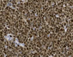 Tissue-Tek Genie<sup>®</sup><br />
anti-MUM-1