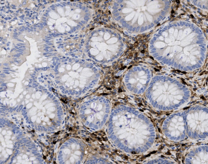 Tissue-Tek Genie anti-Tryptase