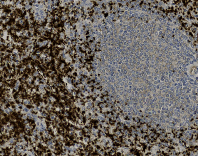 Tissue-Tek Genie anti-CD61