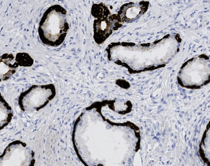 Tissue-Tek Genie anti-Cytokeratin HMW