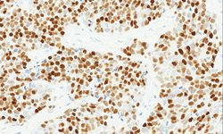 Tissue-Tek Genie<sup>&reg;</sup><br />
anti-INSM1