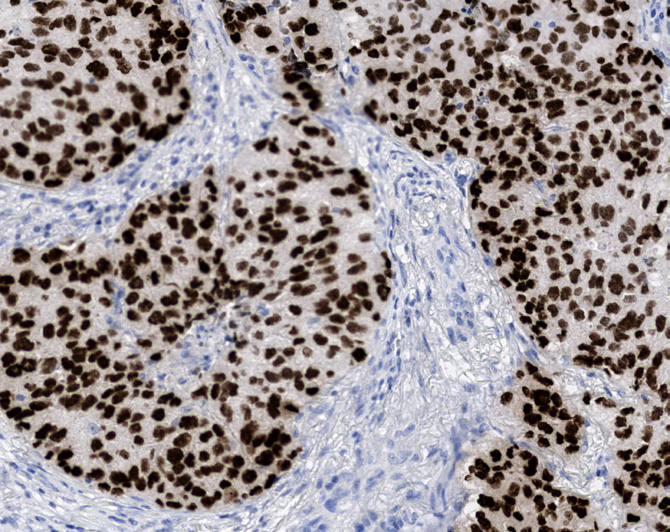 Tissue-Tek Genie<sup>®</sup> anti-Thyroid<br /> Transcription Factor-1 Tissue-Tek Genie<sup>®</sup> anti-Thyroid<br /> Transcription Factor-1