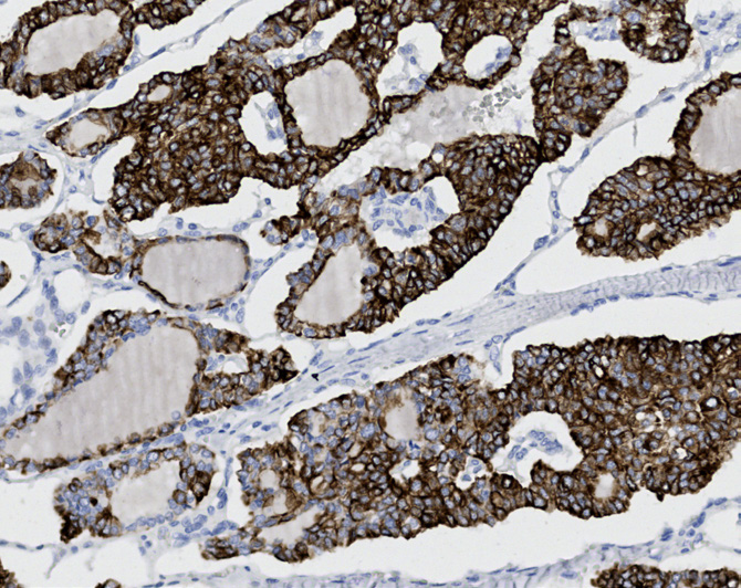 Tissue-Tek Genie<sup>®</sup><br />anti-Cytokeratin 19 Tissue-Tek Genie<sup>®</sup><br />anti-Cytokeratin 19