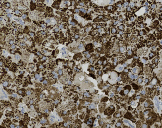 Tissue-Tek Genie anti-Hepatocyte Specific Antigen (HEP PAR 1)