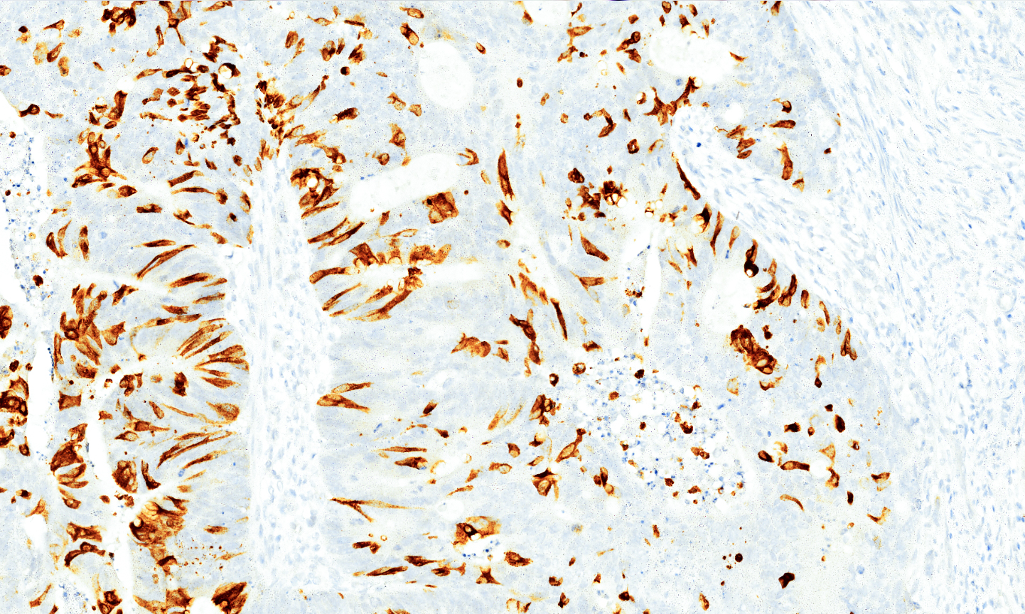 Tissue-Tek Genie anti-MUC2