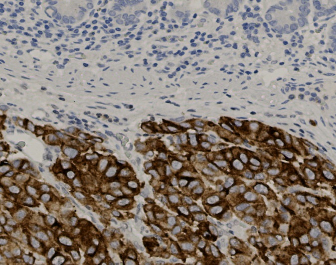 Tissue-Tek Genie<sup>&reg;</sup><br />anti-Melanosome