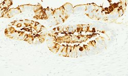 Tissue-Tek Genie<sup>&reg;</sup><br />
anti-MUC5AC