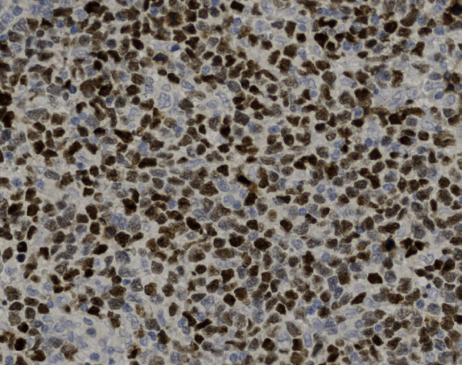 Tissue-Tek Genie anti-SOX11 Tissue-Tek Genie anti-SOX11