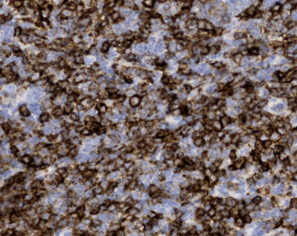 Tissue-Tek Genie anti-CD23 Tissue-Tek Genie anti-CD23