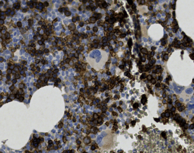 Tissue-Tek Genie<sup>®</sup><br />anti-CD71 Tissue-Tek Genie<sup>®</sup><br />anti-CD71