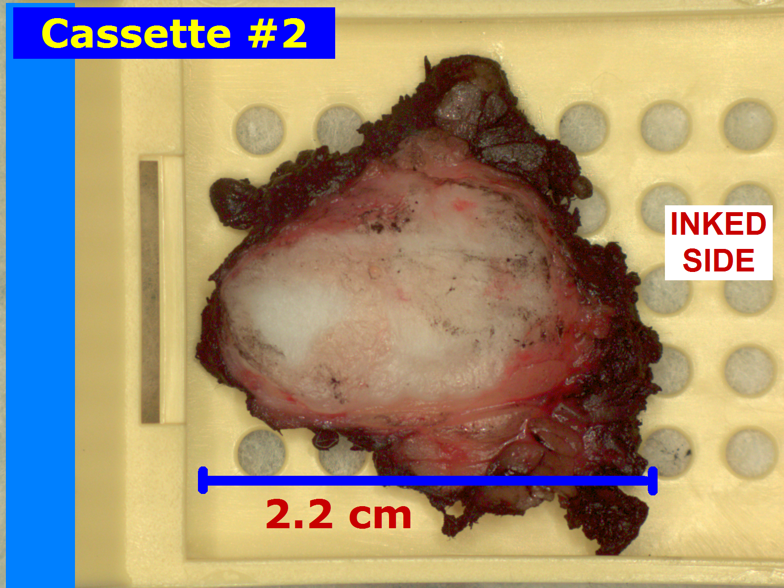 Pathology Camera with Auto-Labeling