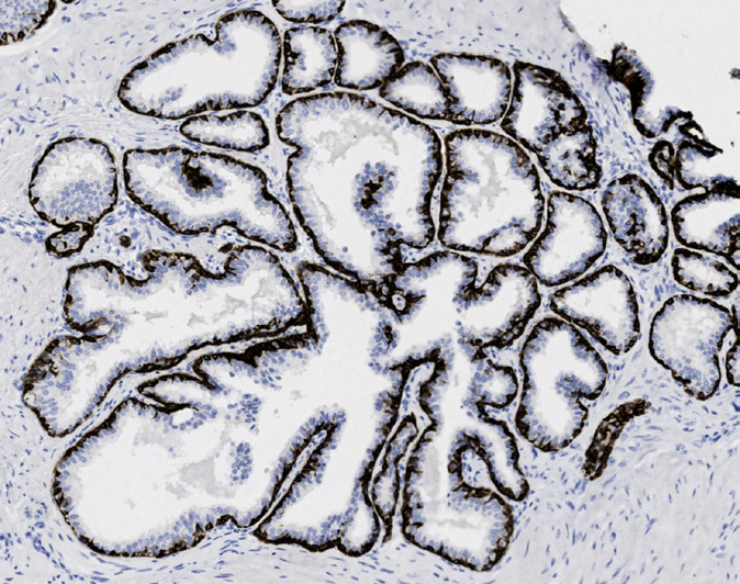 Tissue-Tek Genie anti-Cytokeratin 5/6 Tissue-Tek Genie anti-Cytokeratin 5/6