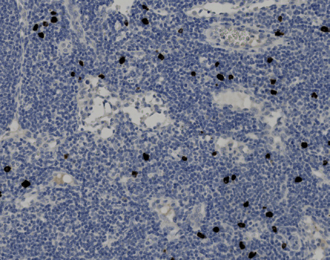 Tissue-Tek Genie<sup>®</sup><br />anti-IgG4 Tissue-Tek Genie<sup>®</sup><br />anti-IgG4