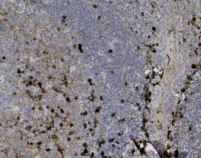 Tissue-Tek Genie<sup>®</sup><br />anti-IgG Tissue-Tek Genie<sup>®</sup><br />anti-IgG