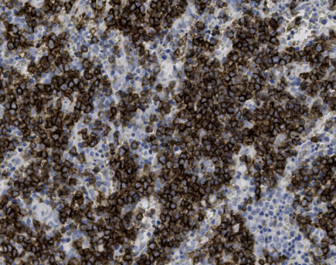 Tissue-Tek Genie anti-CD19