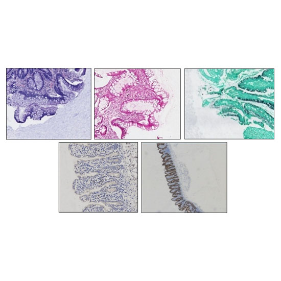 Histology Gel is Resistant to Common Histologic Stains