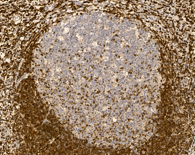 Tissue-Tek Genie<sup>®</sup><br />anti-BCL2 Tissue-Tek Genie<sup>®</sup><br />anti-BCL2